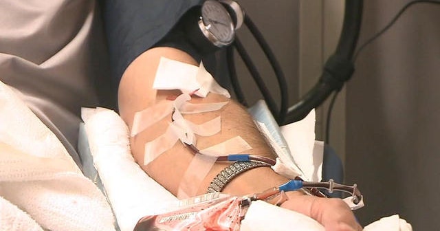 FDA considers lifting ban on blood donations from gay men