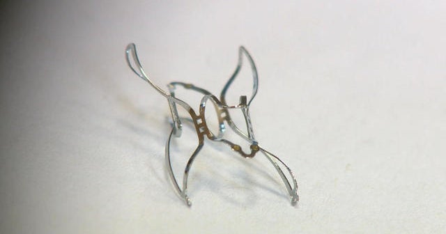 Tiny implant could treat high blood pressure