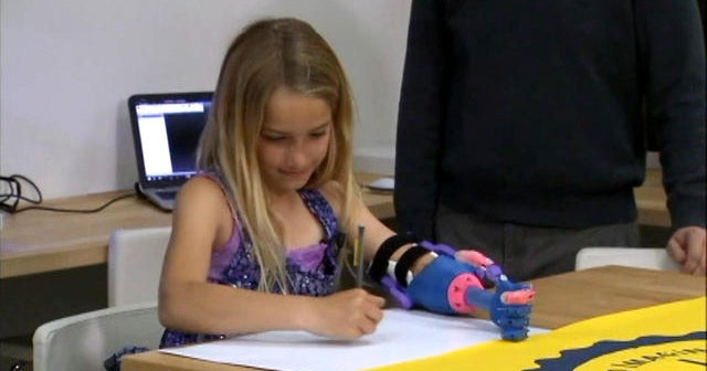 California girl gets high-tech 3D-printed prosthetic hand