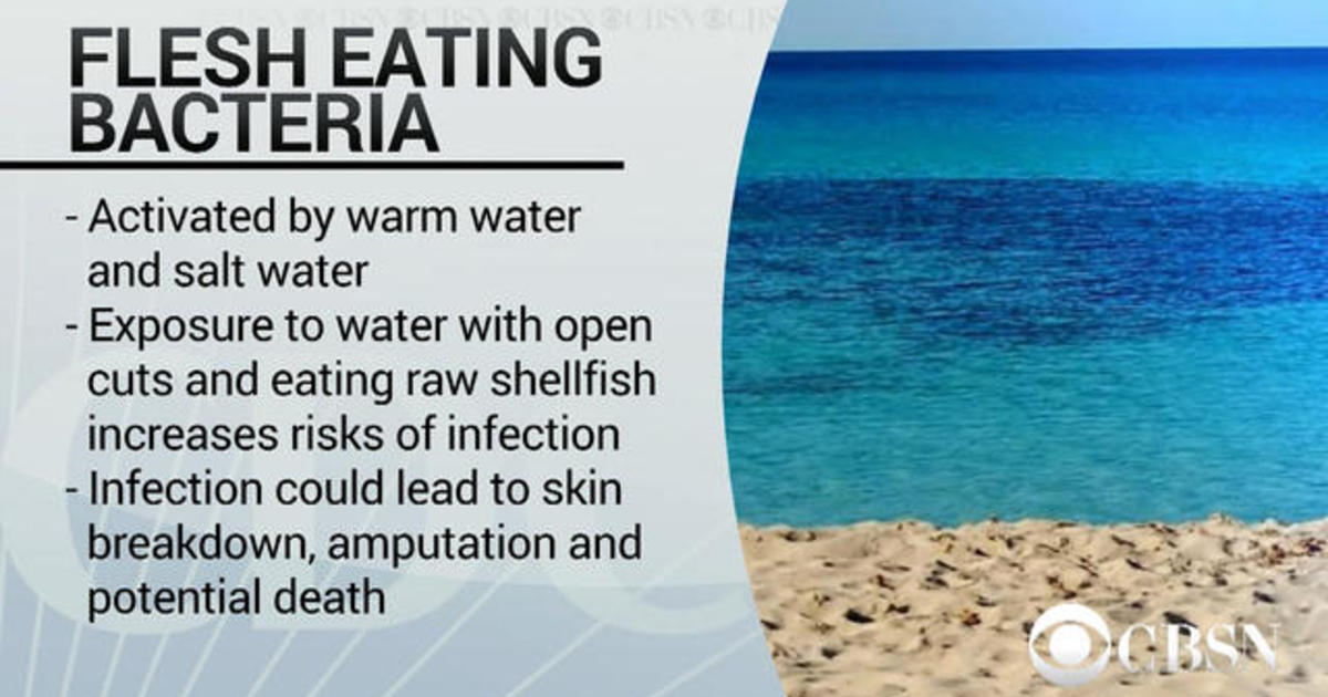 Florida health officials warn beachgoers of flesheating bacteria CBS