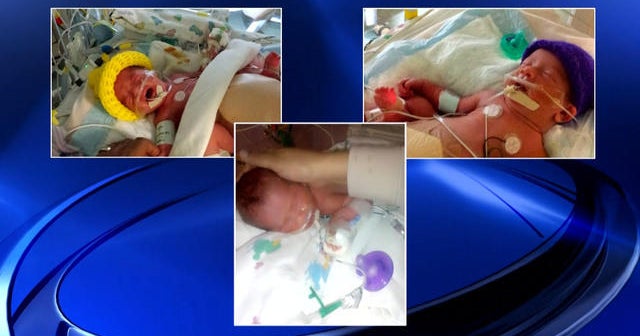 Special triplets born in Texas