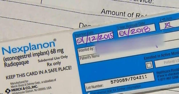Mother with birth control implant still gets pregnant