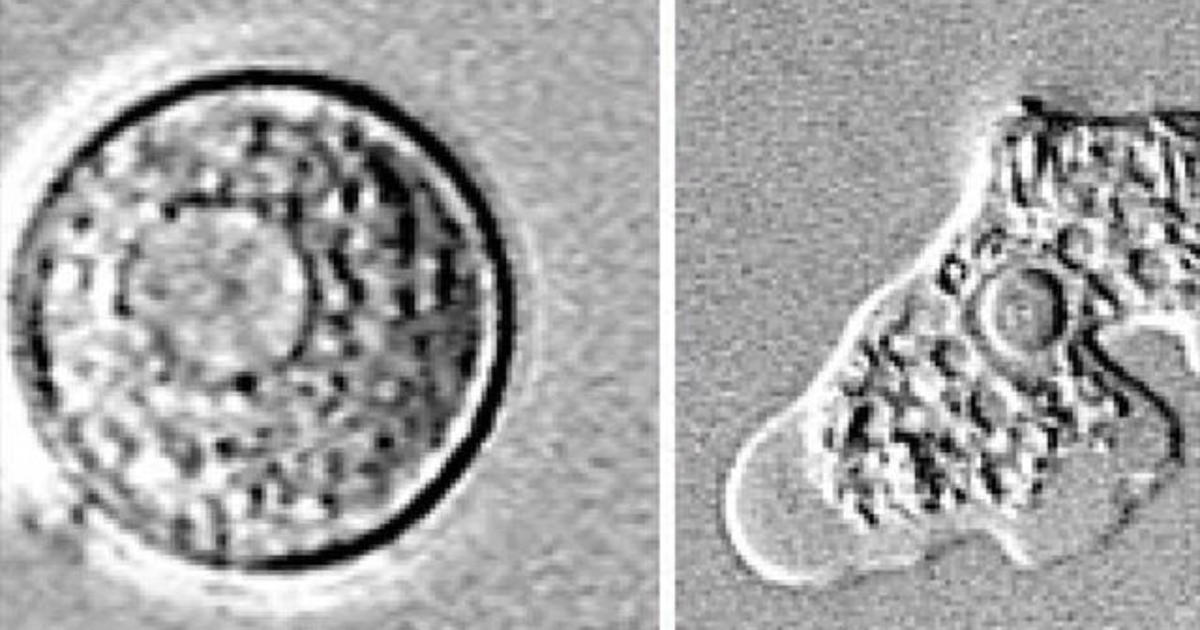 7-year-old dies from rare brain-eating amoeba tied to California lake