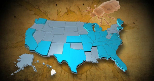 Treatment-resistant super lice are spreading