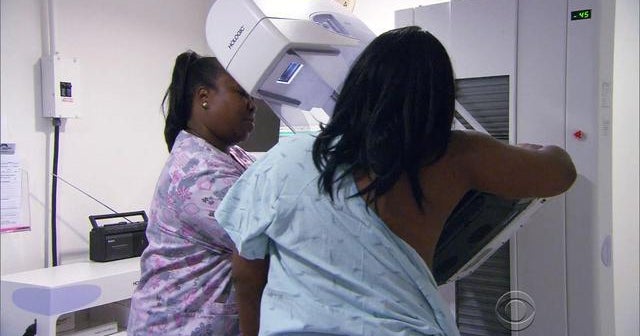 New guidelines on mammograms