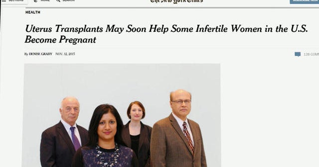 Cleveland Clinic doctors hope to perform first uterine transplant
