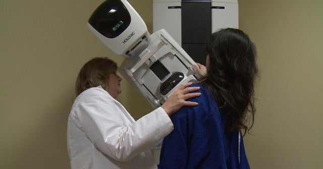 Breaking down the new mammogram guidelines
