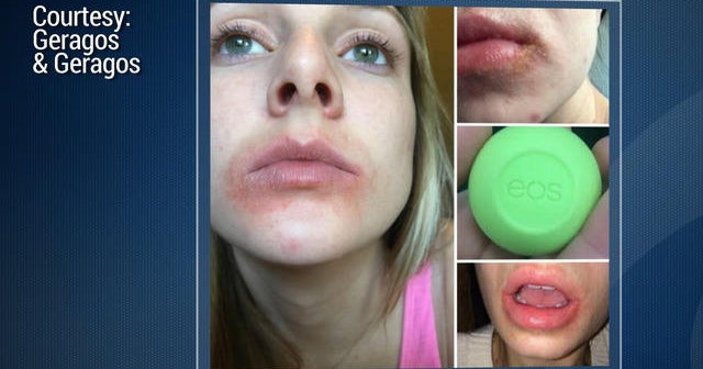 EOS sued over alleged lip balm problems