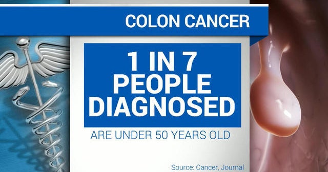 Colon cancer rising among people under 50