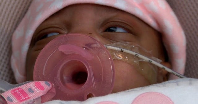 She is feisty: Tiny preemie goes home
