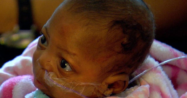 One of the world&rsquo;s smallest surviving babies goes home