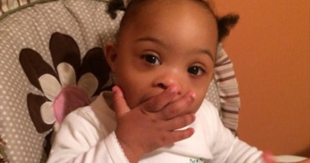 Toddler gets bloodless surgery