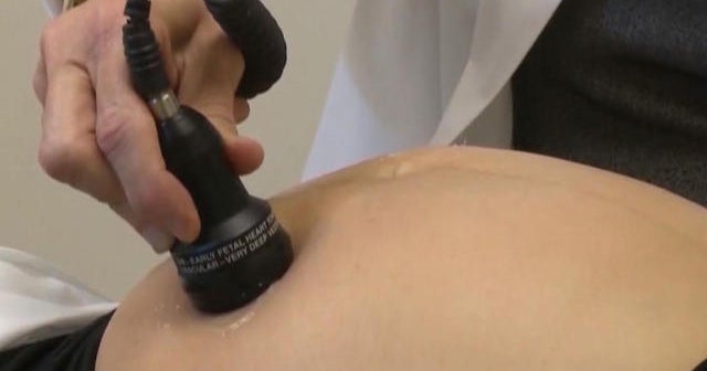 Breaking down study on possible folic acid-autism link