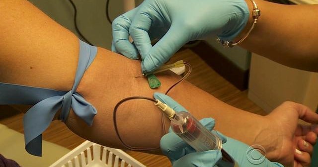 Free Zika tests backlogged in Florida