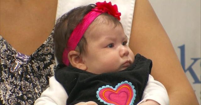 Doctors puzzled by baby born with Zika virus