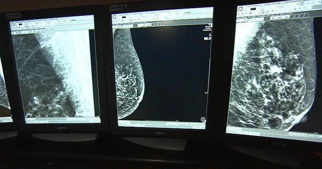 Metastatic breast cancer treatments in development