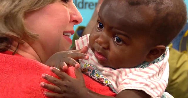 Surgery for baby born with two extra legs