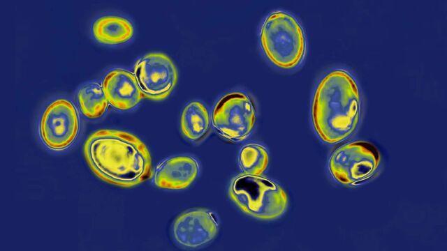 cbsn-fusion-fungal-superbug-causes-concern-among-us-health-officials-thumbnail-759986-640x360.jpg 