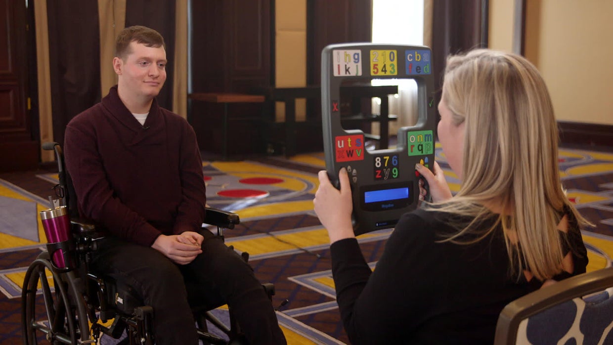 Surviving lockedin syndrome How one man confounded expectations of