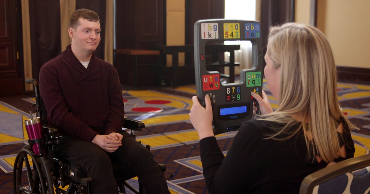 Surviving lockedin syndrome How one man confounded expectations of