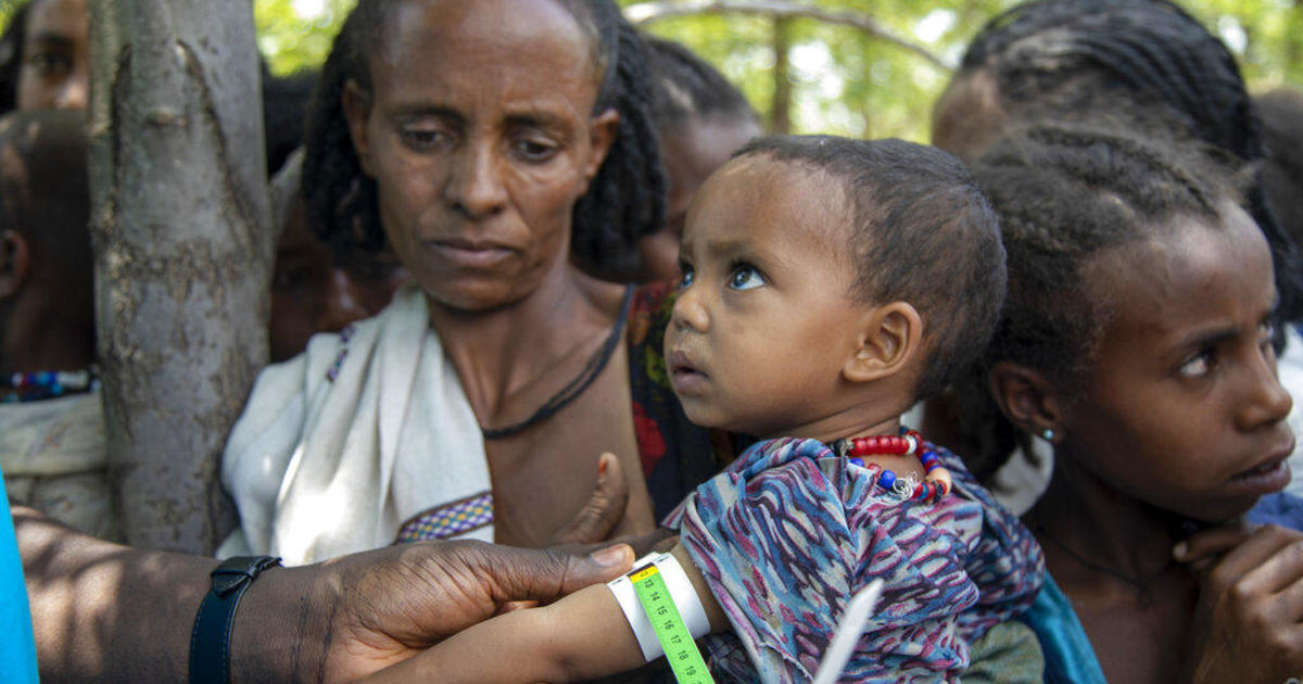 Over 100,000 children could face extreme starvation in Ethiopia's Tigray region