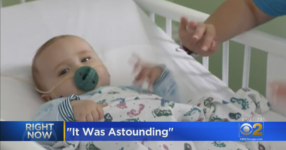 RSV, Respiratory Virus That Usually Affects Babies, Taking Off After Flatlining Last Year CBS