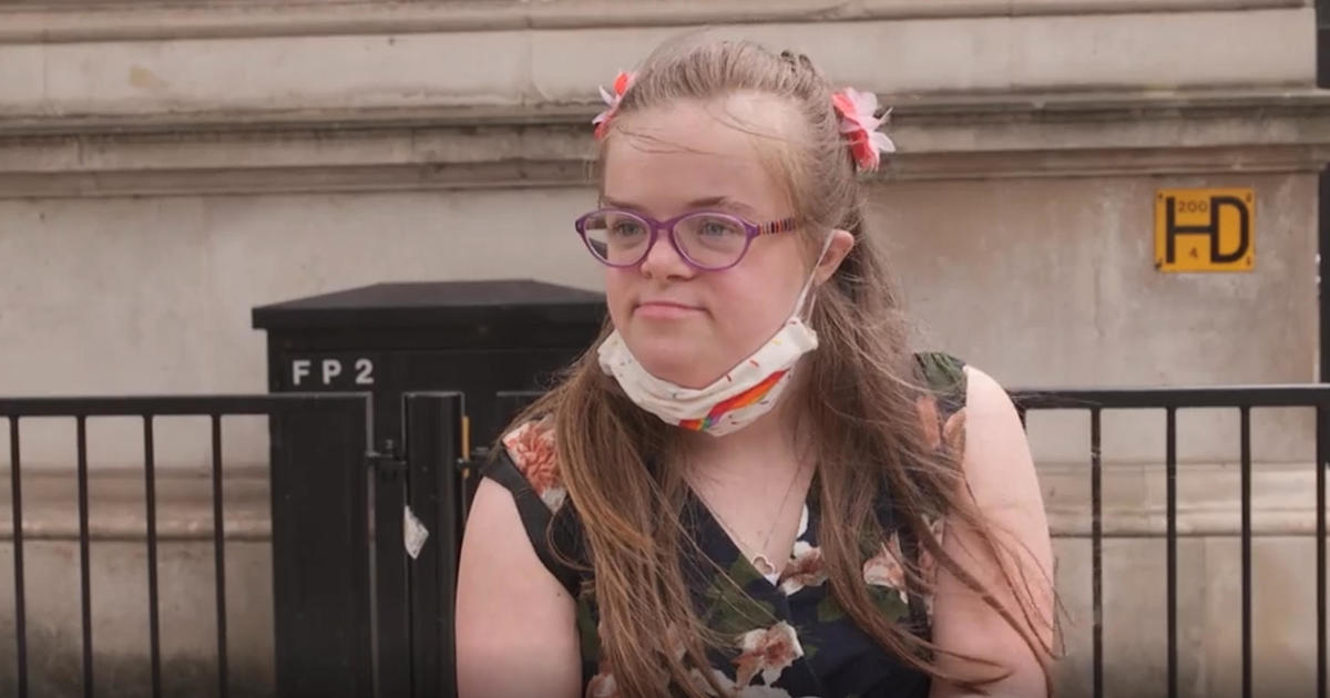 Court dismisses challenge to U.K. law allowing abortion of a fetus with Down syndrome until birth