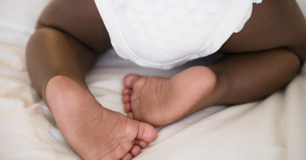 Pandemic has exacerbated "diaper need" in the U.S.