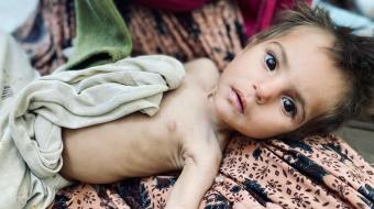 Taliban blames U.S. as 1 million Afghan kids face death by starvation 