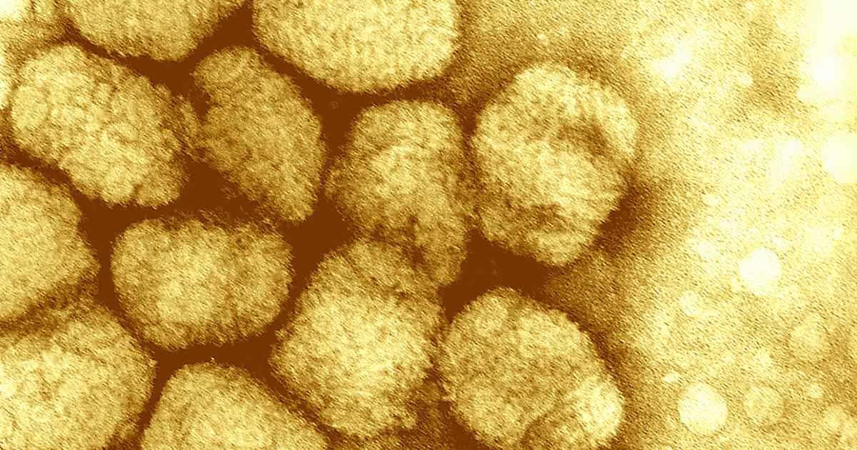 Vials labeled "Smallpox" found in Pennsylvania lab freezer have no trace of virus, CDC says