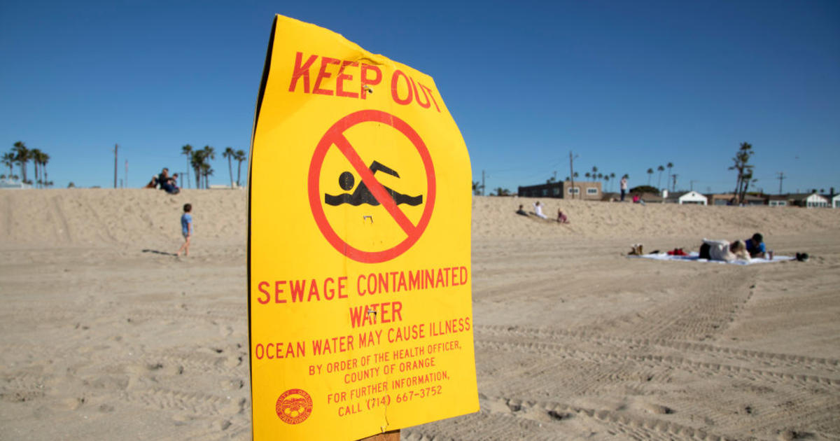 Southern California beaches closed after massive sewage spill