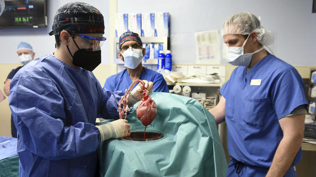 Pig Heart Transplant 