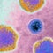 Hepatitis outbreak among children grows in U.S.