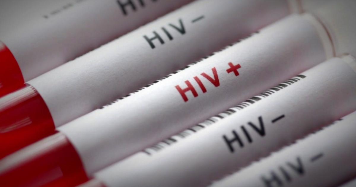 Long-term survivors living with HIV about 30 years after diagnosis: “We are still here”