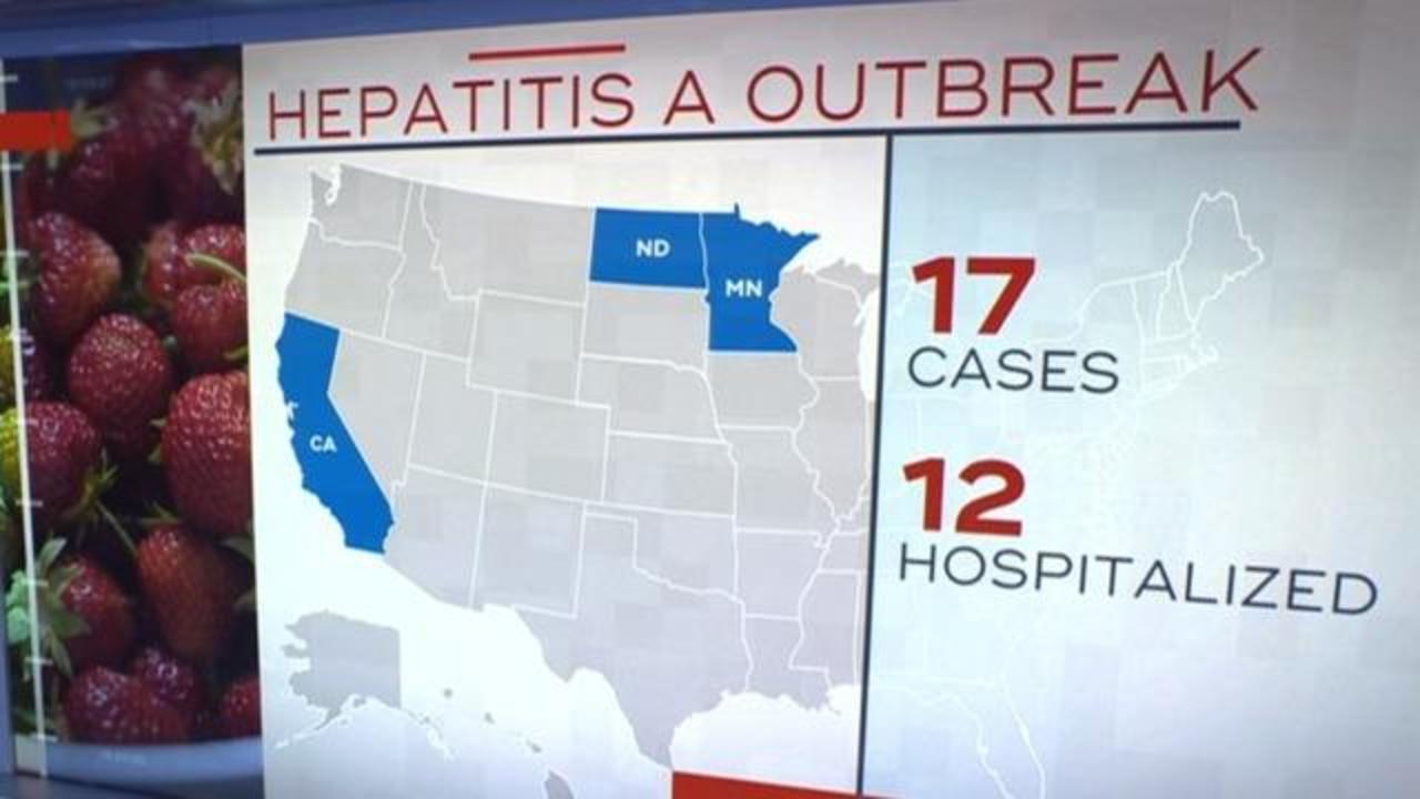 Hepatitis A outbreak possibly linked to strawberries - CBS News